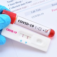 covid test