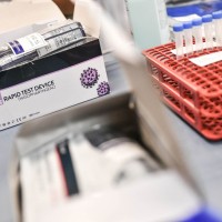 hitri test, koronavirus, Evropska komisija predlaga tudi skupno nabavo antigenskih testov