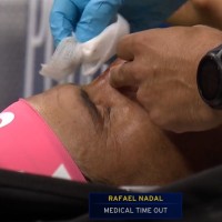 nadal