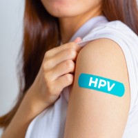 hpv obliž