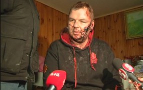 Ukrajinskega aktivista pretepli, ga križali in mu odrezali del ušesa