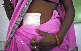 Za smrti žensk po sterilizaciji v Indiji verjetno kriv podganji strup