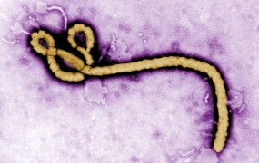 Svetovna banka namenila 200 milijonov dolarjev za boj proti eboli