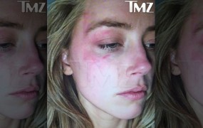 Padec še enega idola: Johnnyja Deppa žena Amber obtožuje, da jo je pretepel