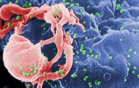 V Avstraliji razglasili "konec aidsa" kot smrtonosne epidemije