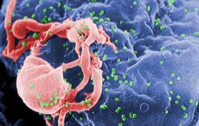 Italijan z virusom hiv okužil 30 žensk; bo umrl za rešetkami?