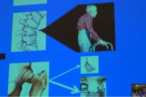 VIDEO: Predavanje o osteoporozi 