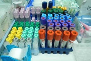 Virus zahodnega Nila že zaznali tudi pri nas; stroka poudarja, da razloga za skrb ni