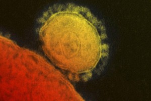 Smrtonosni virus iz Savdske Arabije prispel v ZDA