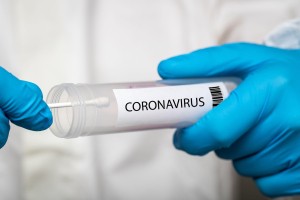 KORONAVIRUS: Včeraj potrdili dve novi okužbi