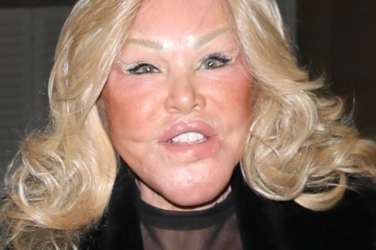 Jocelyn Wildenstein