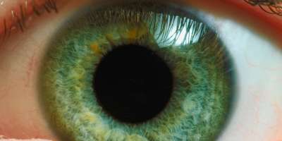 Mrežnica (retina)