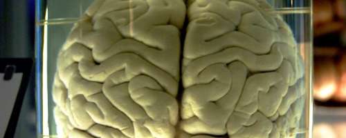 Ali lahko obudimo možgansko mrtvega pacienta?