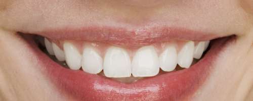 Koliko vam pomenijo vaši zobje?