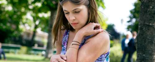 Alergija na sonce: Domača zdravila proti srbenju in izpuščajem