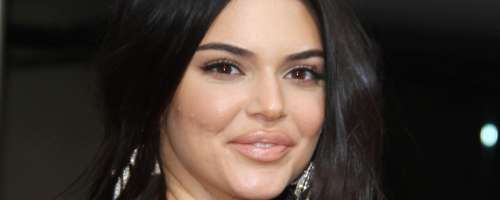 Kendall Jenner ima hude težave z aknami