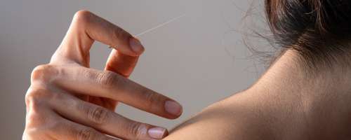 Kdaj je akupunktura učinkovita?