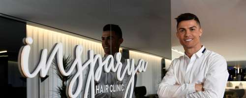 Ronaldo se bojuje proti izpadanju las