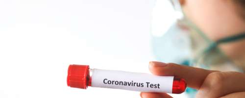 Začenja se raziskava o razširjenosti novega koronavirusa med prebivalstvom
