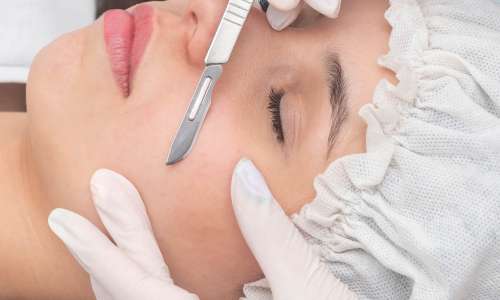 Dermaplaning - leptni trend, ki ga številni še vedno ne razumejo