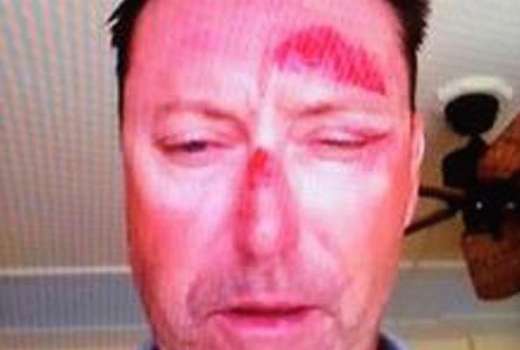 allenby-bashed.CACHE-924x924-20150118143729
