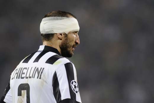 936-12-13-chiellini re