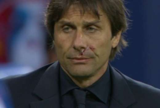 conte