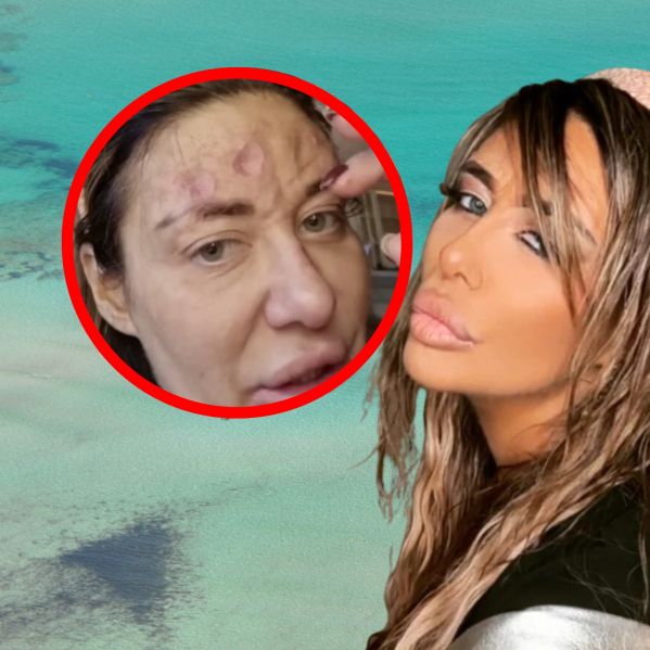 Ana je zaradi različnih kožnih težav obiskovala bolnišnico, vendar ni nadaljevala s predpisanimi terapijami.