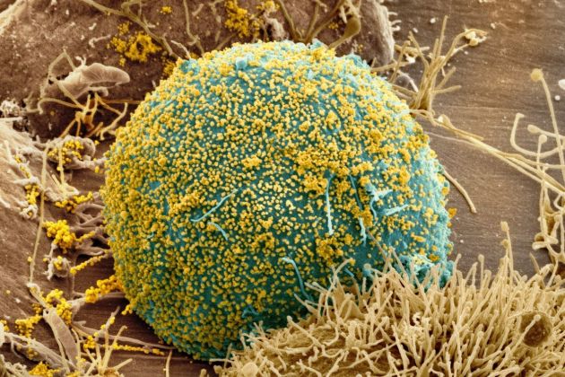 celica okužena z virusom HIV