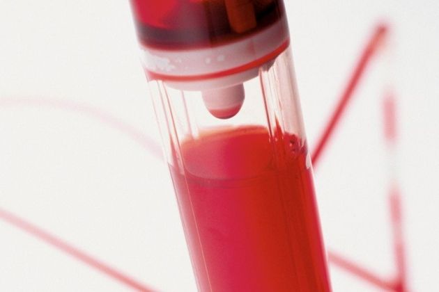 transfuzija, kri.jpg