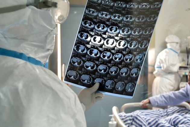 zdravnik, izvid, koronavirus.jpg