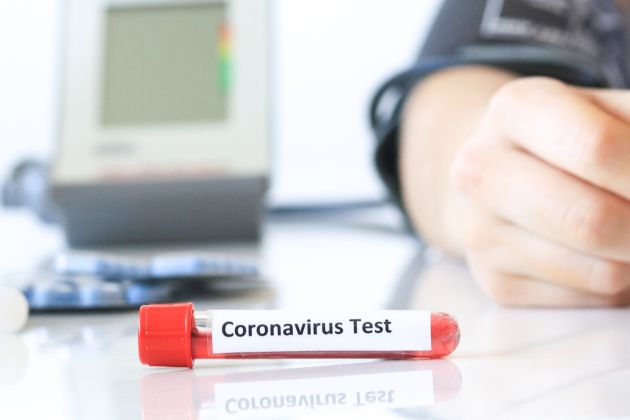 koronavirus, zdravstvo, epidemija