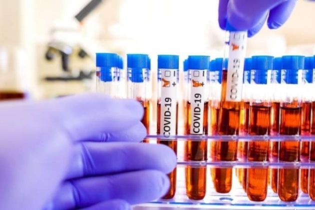 Testiranje na koronavirus.jpg