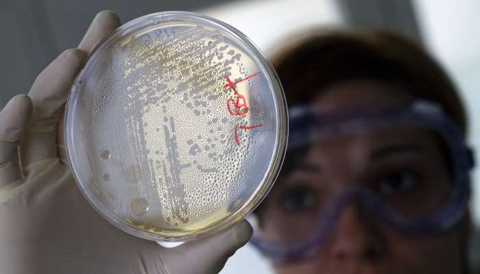 bakterija e.coli antibiotik