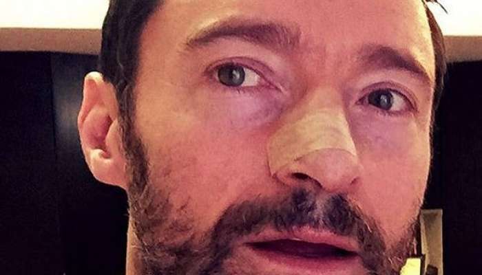 Hugh-Jackman