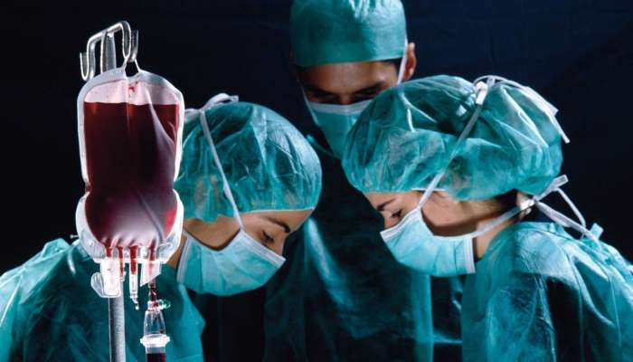 zdravniki, darovanje organov, operacija, kirurg