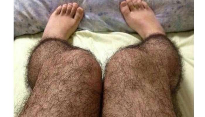 Hairy_legs