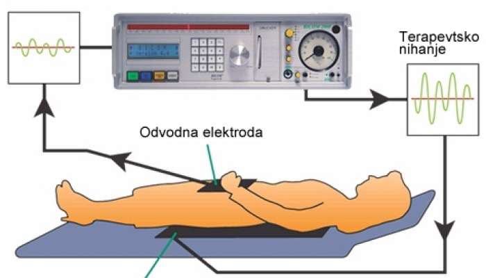 bioresonanca