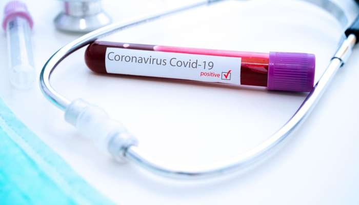 koronavirus covid-19