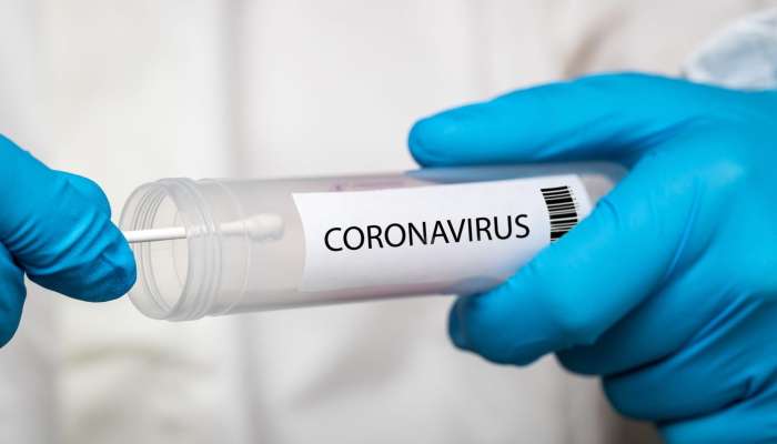 koronavirus, test