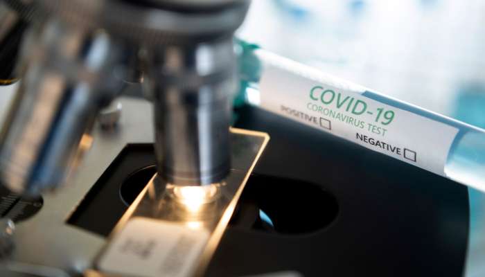 koronavirus, covid-19, testiranje, test