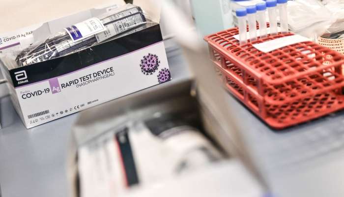 hitri test, koronavirus, Evropska komisija predlaga tudi skupno nabavo antigenskih testov