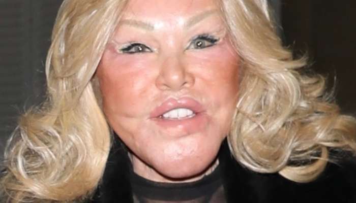 Jocelyn Wildenstein