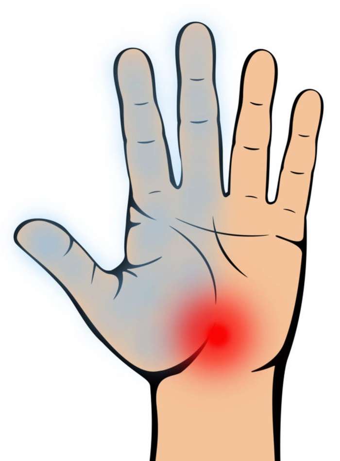 Kaj nam sporočajo bolečine v dlaneh?