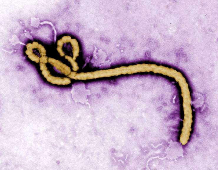 Verjetnost, da ebola pride v Slovenijo, po navedbah strokovnjakov majhna