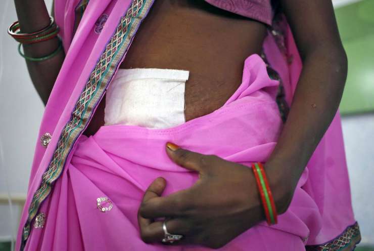Za smrti žensk po sterilizaciji v Indiji verjetno kriv podganji strup