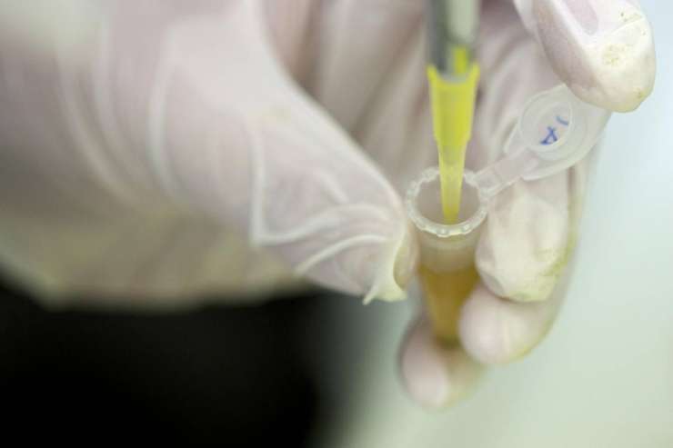 Ženska v Avstriji ni umrla zaradi ebole
