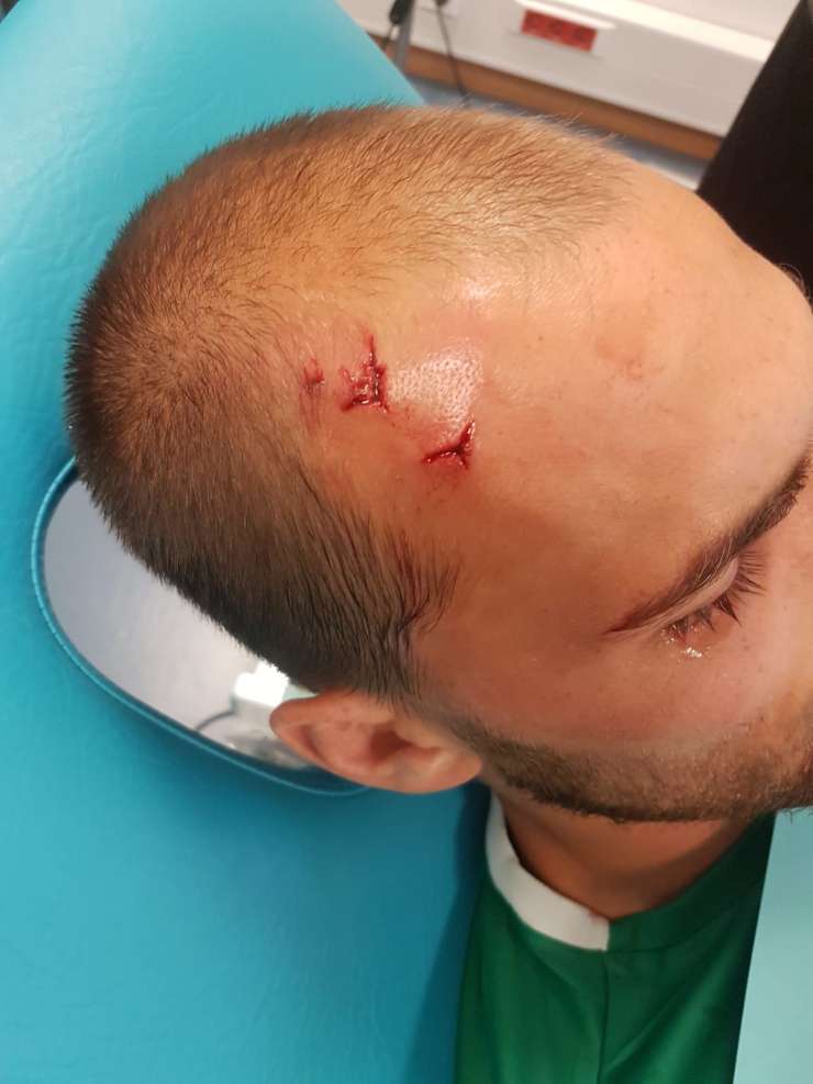 "Navijači" Sportinga so napadli trening kamp, zabodli fizioterapevta in pretepli najboljšega igralca