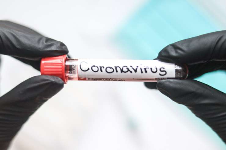 KORONAVIRUS: Včeraj umrl en bolnik s covidom-19, novih okužb ni bilo