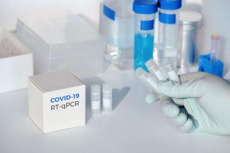 V Slovenijo iz Kitajske prihajajo testi za novi koronavirus